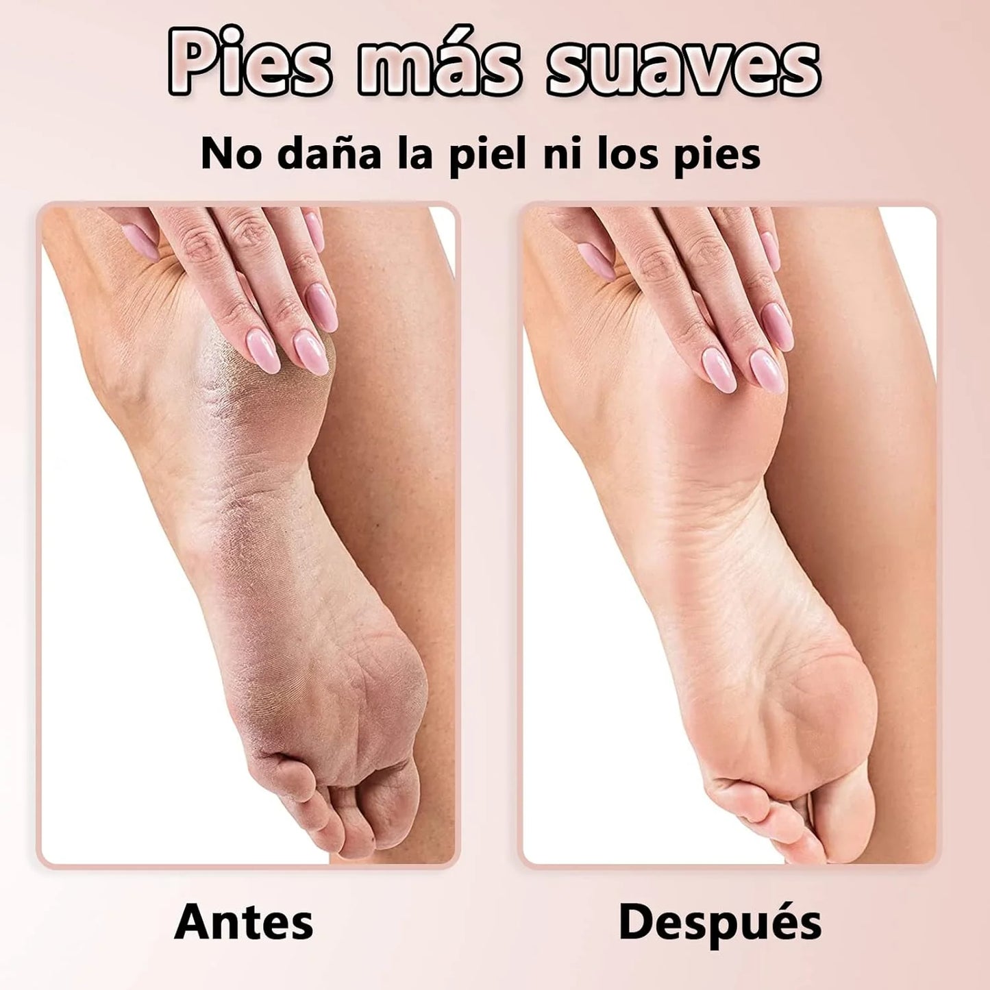 Lima Eléctrica Quita Callos y Durezas – Pedicura Profesional en Casa.